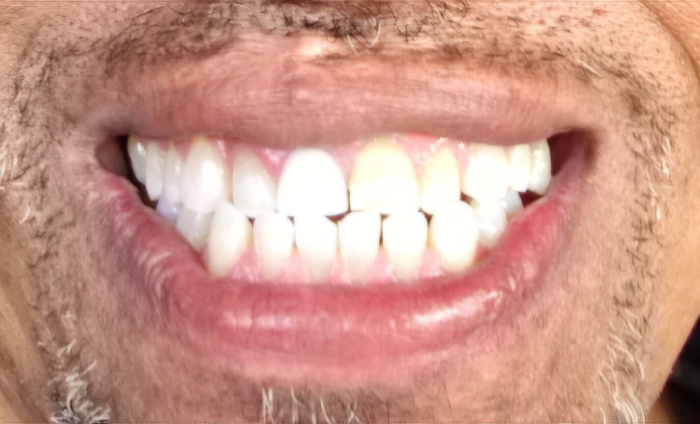 1000010133