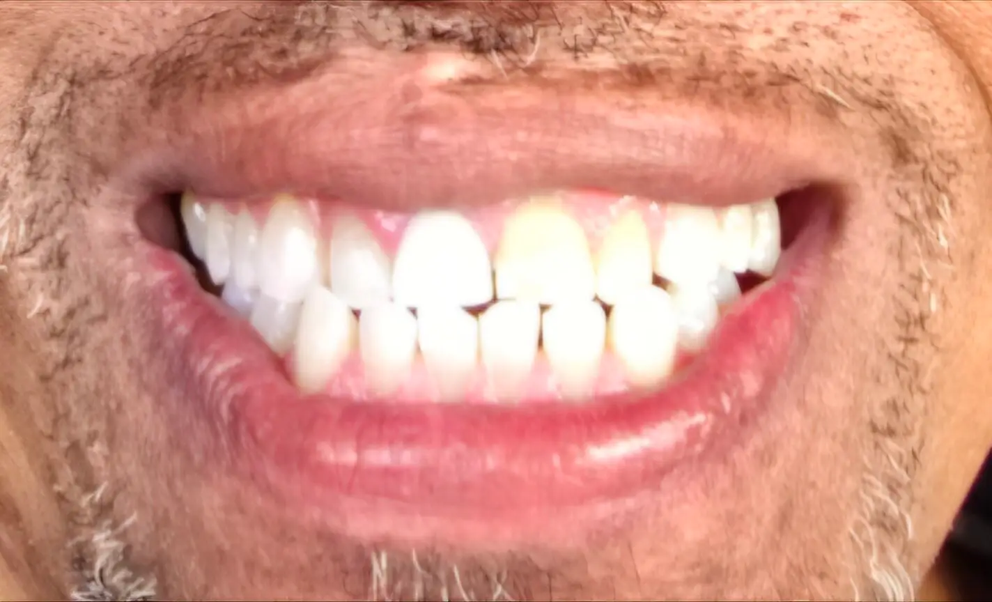 1000010133